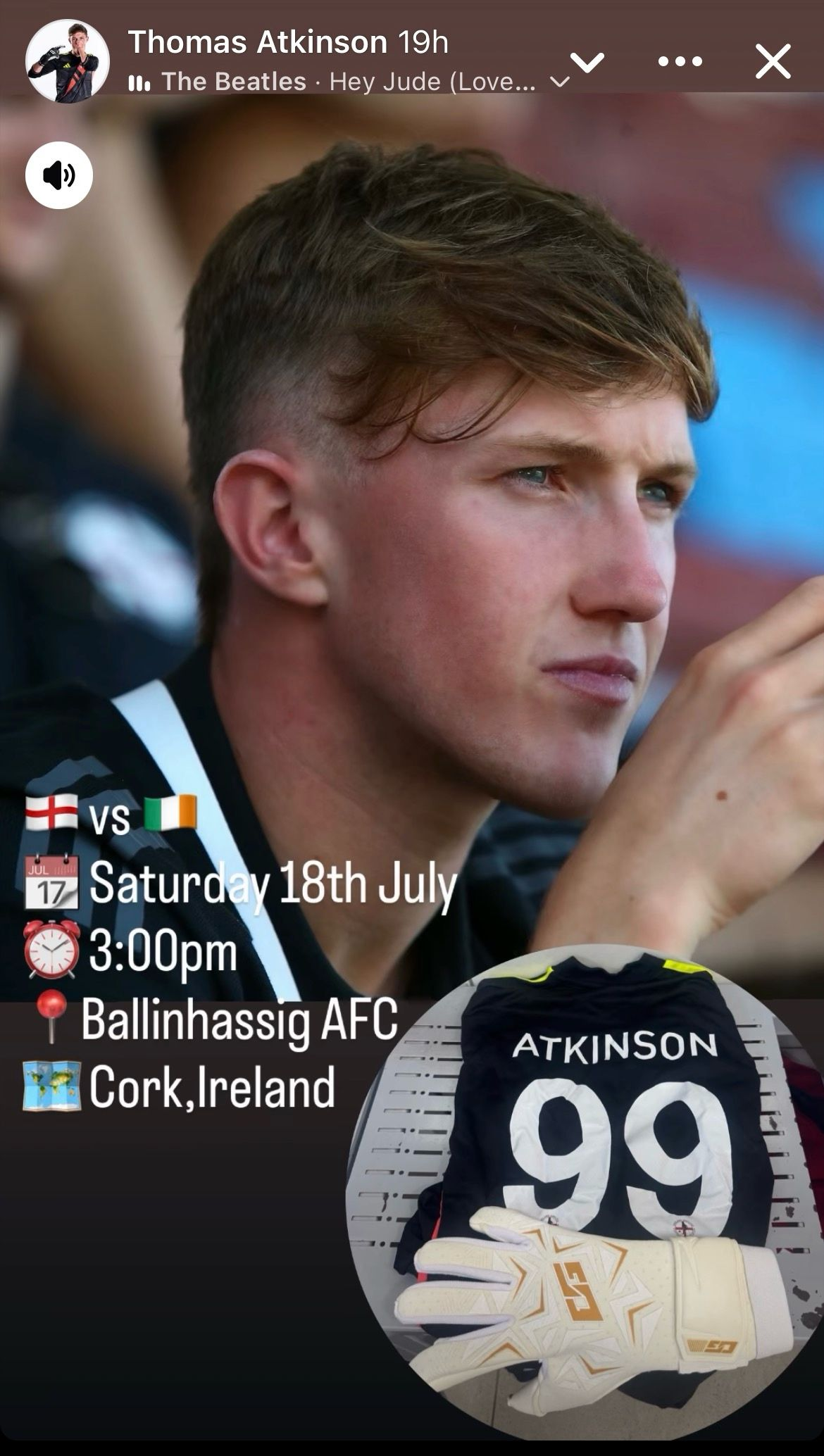 Thomas Atkinson matchday England vs Ireland fixture